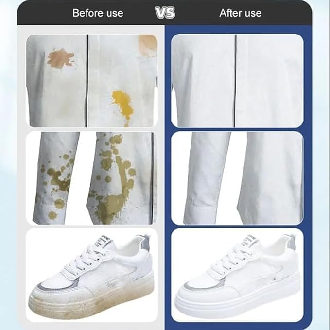 5/10PCS Portable Emergency Stain Removal Wet Wipes Emergency Stain Remover Wipes Stain Remover for Clothes Laundry Wipes Stain Remover Wipes Individually Wrapped (5PCS)