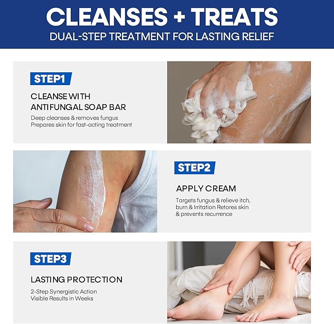 Hermon Clotrimazole Antifungal Treatment Cream &amp Soap Kit: Antifungal Cream for Athletes Foot Jock Itch Ringworm with Anti Fungal Soap - Relieves Itching Burning Cracking - 57g Tube / 113g Bar